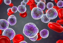 Blinatumomab Significantly Improves Disease-Free Survival in B-ALL