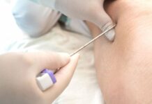 Zanubrutinib Provides Durable Responses in Waldenström macroglobulinemia